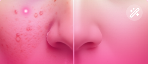 Skin Correction Therapies